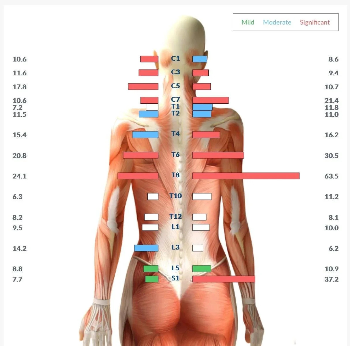 Muscle tension scan chart
